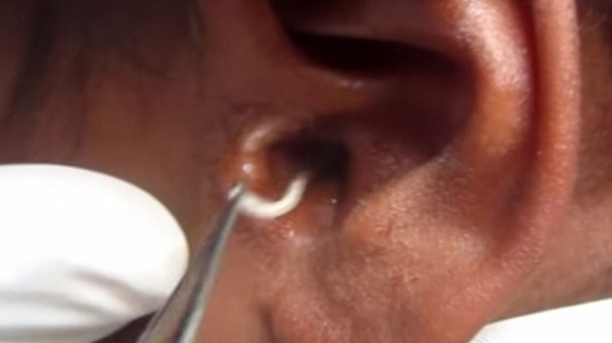 Kulağından çıkana inanamayacaksınız!