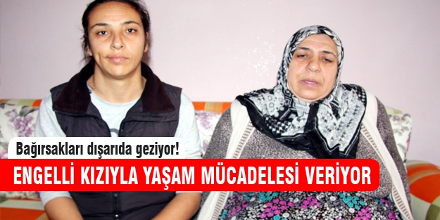 Karpuz büyüklüğündeki bağırsaklarla dışarıda geziyor