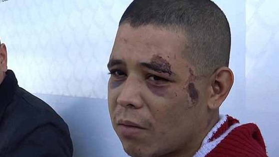 Arkadaşının cinsel organını kesip...