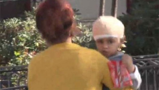 Kafasına düşen taş hayatını kurtardı