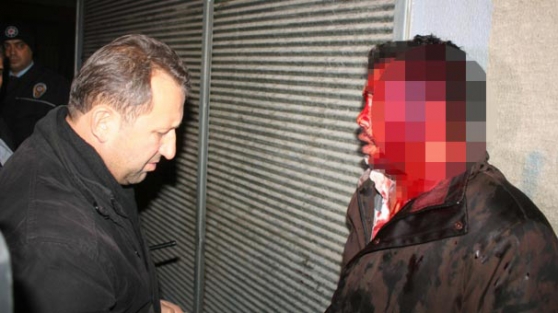 Suriyeliyi hırsız sanınca...