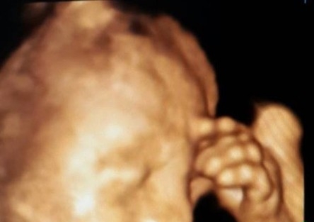 Anne Karnında Düşünen Bebek