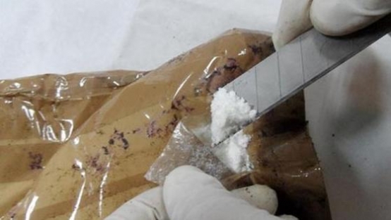 Cesedin midesinden çıkan öyle bir şey çıktı ki!