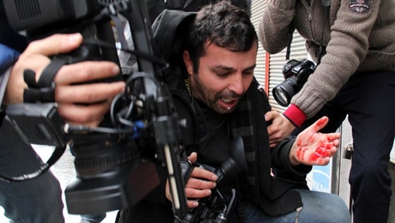 Hakkari'deki olaylarda muhabir de yaralandı