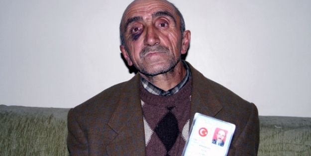 Bedelli parasını vermeyen babasını dövdü