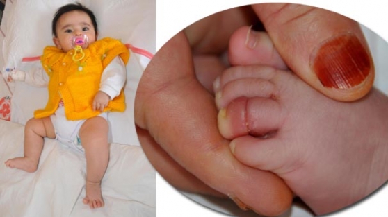 Annesinin saçı kangren edecekti!