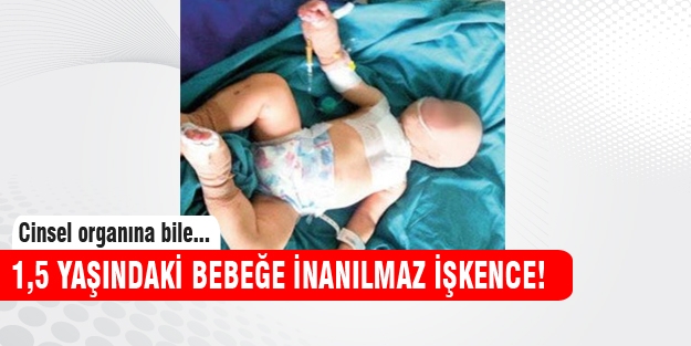 Bebeğin cinsel organında sigara söndürdüler!