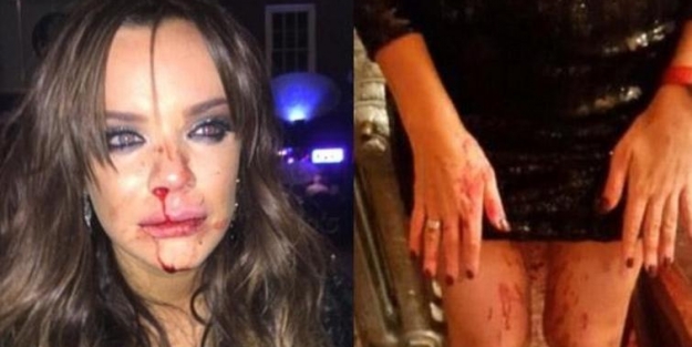 Dizi oyuncusuna saldırı