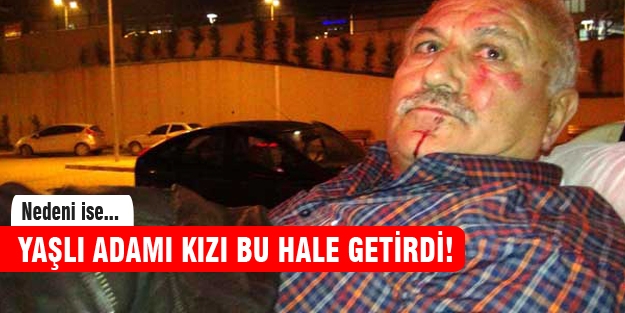 Yaşlı adamı kızı bu hale getirdi