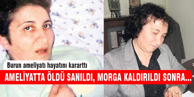 Burun ameliyatı hayatını kararttı!