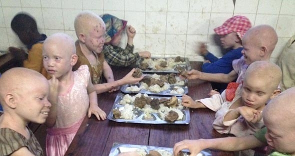 Burhaniye Belediyesi Tanzanya’daki "albino Köyü"ne Destek Olacak