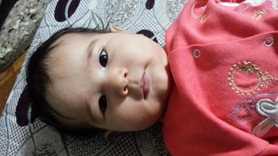 5 aylık bebek balon kurbanı oldu