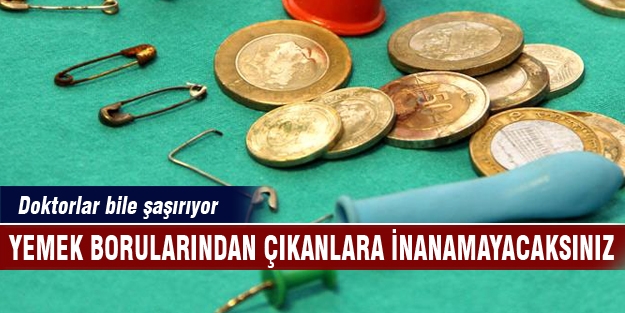 Çocukların nefes borularından çıkanlar şaşırtıyor!