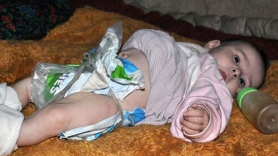 9 aylık bebeğine süt yerine çay içiriyor