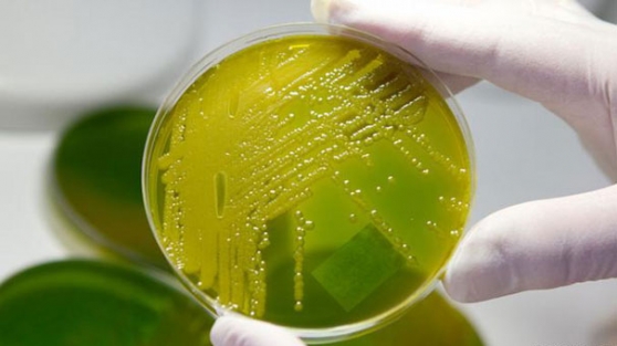 Türkiye tatili dönüşü 11 kişiyi öldürdü