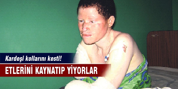 Vahşet! Etlerini kaynatıp yiyorlar