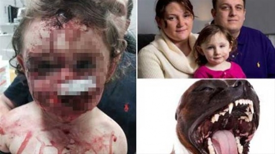 18 aylık bebek bu hale geldi