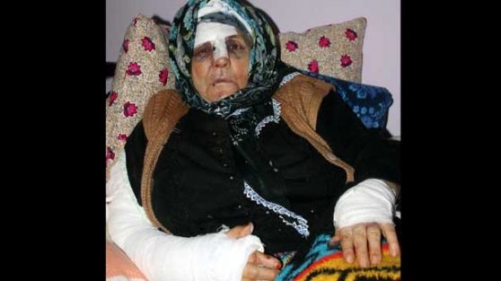 Altın yüzük için 76 yaşındaki kadını dövdüler!