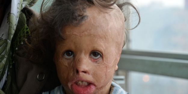 Korkmayın ve yardım elinizi uzatın