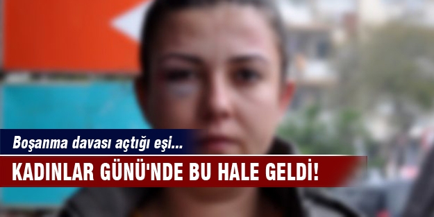 Kadınlar Günü'nde bu hale geldi!