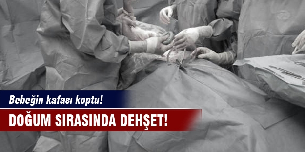 Doğum sırasında dehşet! Doğumda bebeğin kafası koptu!