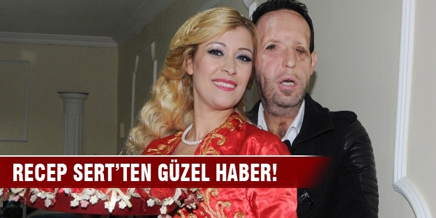 Recep Sert’ten güzel haber