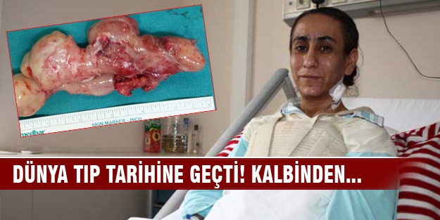 Dünya tıp tarihine geçti!