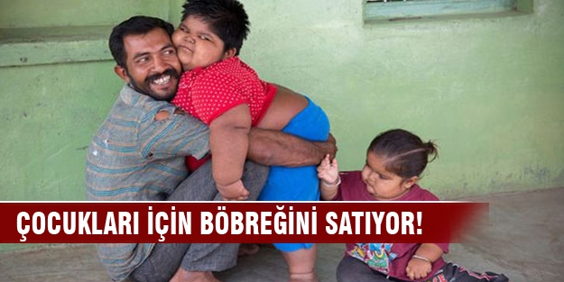 Obez çocuklarının tedavisi için böbreğini satıyor