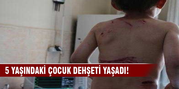 Köpekler saldırdı!