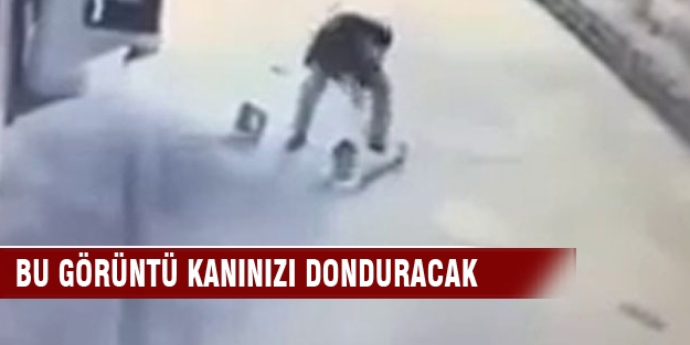 Kan donduran görüntü