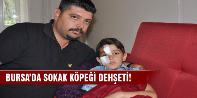 Bursa'da  köpek saldırısı dehşeti!