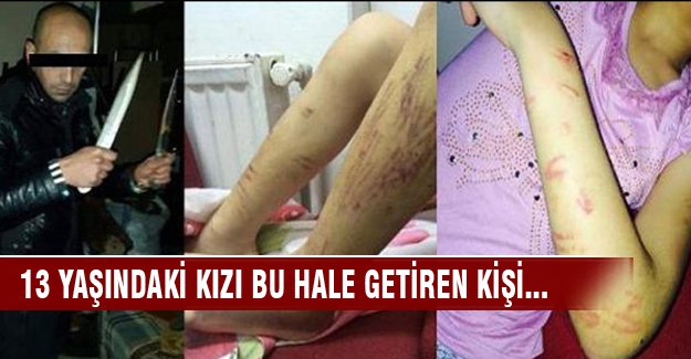 Uyuşturucu bağımlısı babadan kızına feci işkence!