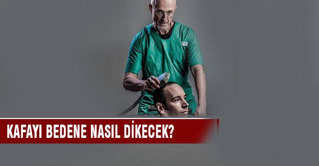 Kafa nakli ile ilgili merak edilenler