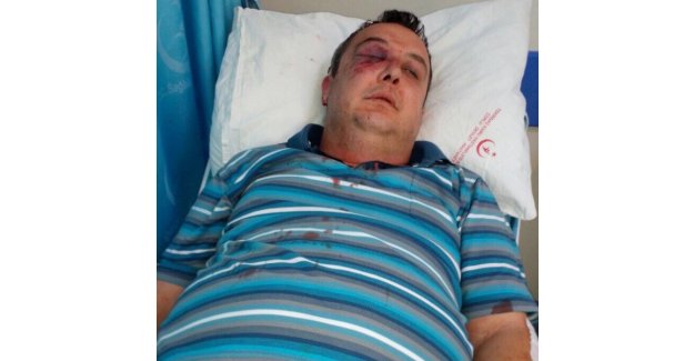 Suyu kesen görevliye dayak