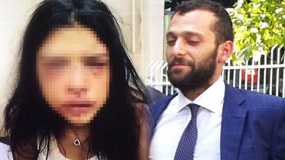 Özbizerdik'in dövdüğü sevgilisine çağrılı koruma tahsis edildi