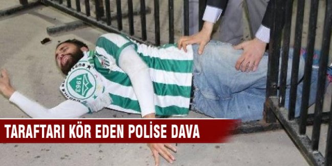 Taraftarı kör eden 2 polise dava