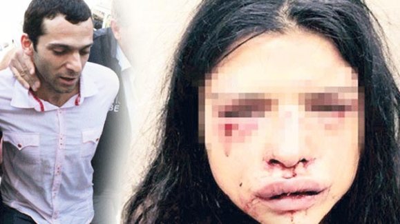 Onur Özbizerdik teslim oldu, serbest bırakıldı