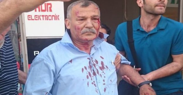 İki bombalı saldırıdan da sağ kurtuldu