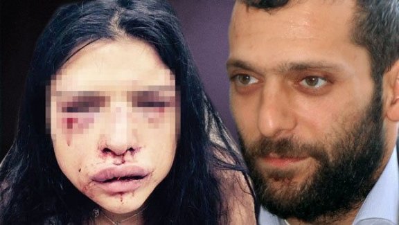 Onur Özbizerdik’in sevgilisi  "Hayattayım tatildeyim şikayetçi değilim"