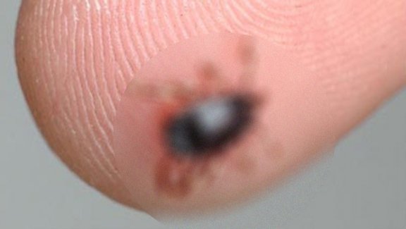 Kene kabusunda 2 kişi hayatını kaybetti