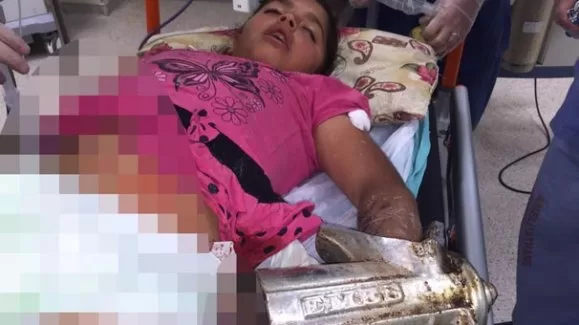 Tarhana öğütürken kolundan oldu