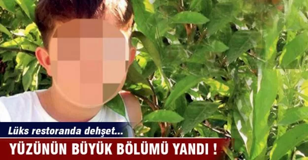 Lüks restoranda ‘kezzap’ dehşeti