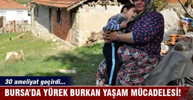 Küçük yaşına rağmen 30 ameliyat geçirdi