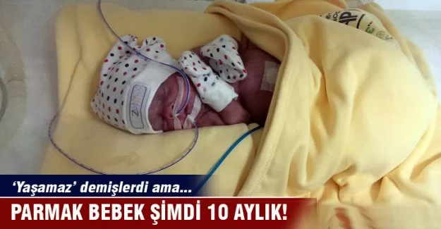 Yaşamaz denilen parmak bebek görenleri şaşırtıyor