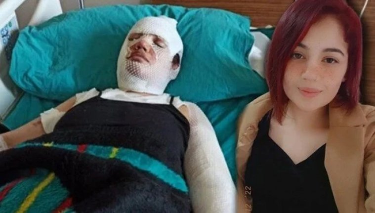 Dehşete düşüren vahşet! Depremzede eski eşini kaynar suyla yaktı, 'Artçı sarsıntı nedeniyle oldu' dedi