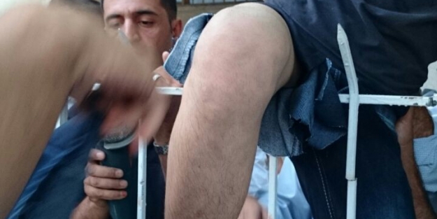 Ağaca kaçan topu almak isterken demir bacağına saplandı İZLE