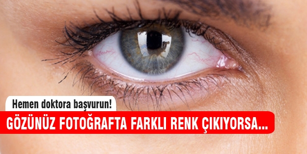 Gözünüz fotoğraflarda farklı renk çıkıyorsa dikkat!