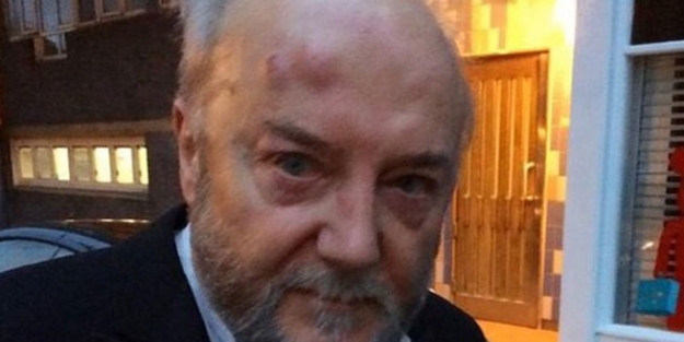 Vekile sokak ortasında dayak