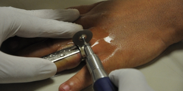 Hamile kadının parmağında yüzük kalınca...