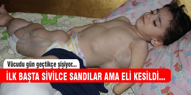 2 buçuk yaşındaki çocuğun vücudu gün geçtikçe şişiyor!